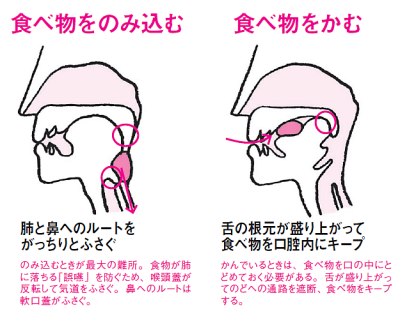 大人の「溶連菌」の症状や薬・検査について【放置するとどうなる？】 | ひまわり医院（内科・皮膚科）