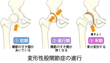 膝がカクカクする原因とは？違和感を改善する方法も紹介 | くまのみ整骨院グループ