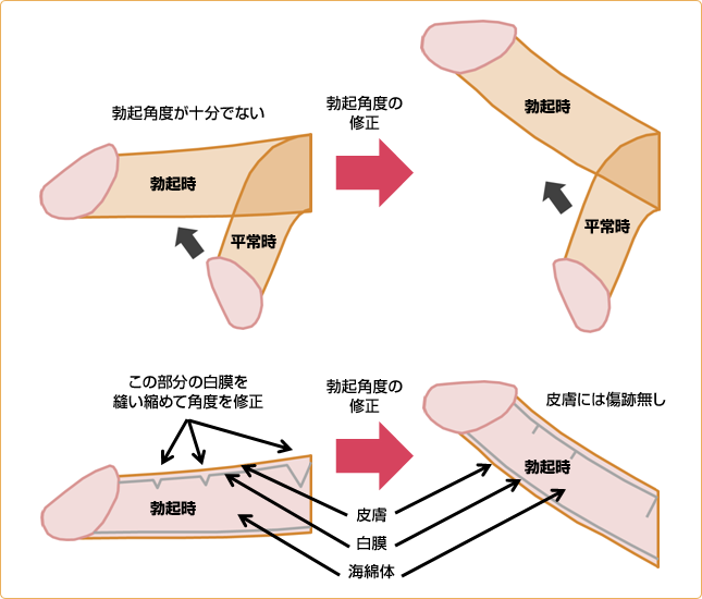 男性がパイパンにする陰毛処理のやり方を紹介 | メンズ脱毛百科事典 リンクスペディア