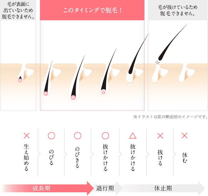 メンズTBCの脱毛の口コミ・評判を調査！料金が高すぎる？メリットやデメリットなども紹介